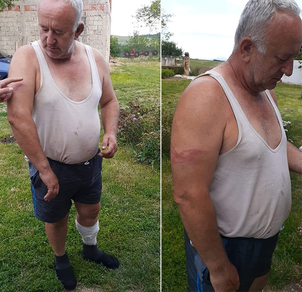 Претучен једини српски повратник у село Опрашке код Истока: Египћани га напали с леђа, тукли док се није онесвестио! (ФОТО)